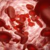 ارتباط بین HIV و کم خونی؟