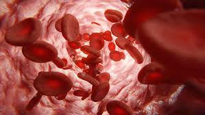 ارتباط بین HIV و کم خونی؟